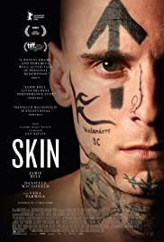 Skin.jpg